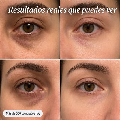 Bálsamo Anti-Arrugas Solvia