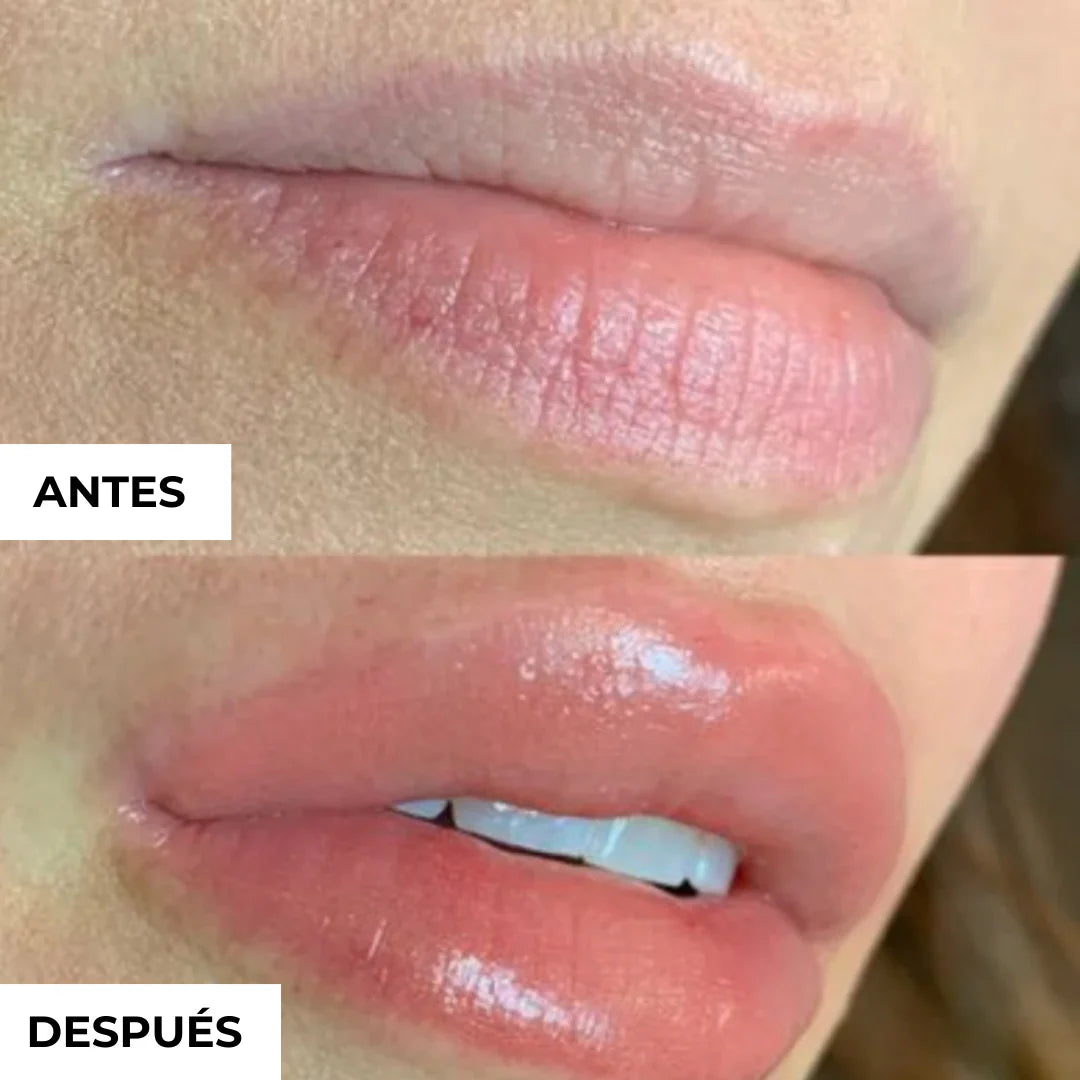 Voluminizador de Labios Solvia