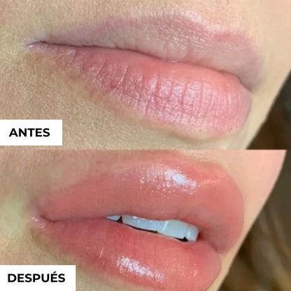 Voluminizador de Labios Solvia