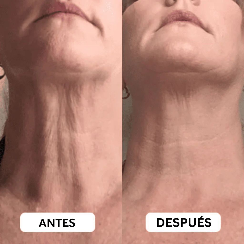 Crema Reafirmante para Cuello de Solvia