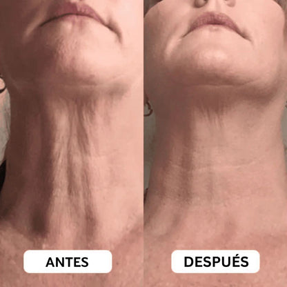 Crema Reafirmante para Cuello de Solvia