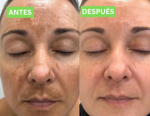 Almohadillas Antienvejecimiento Solvia