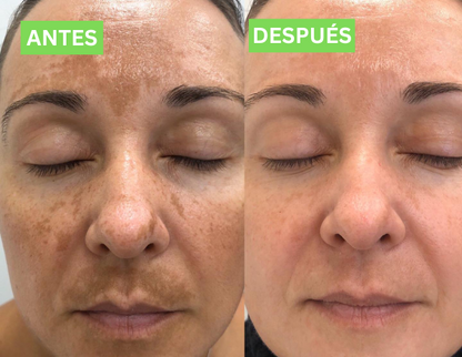 Almohadillas Antienvejecimiento Solvia