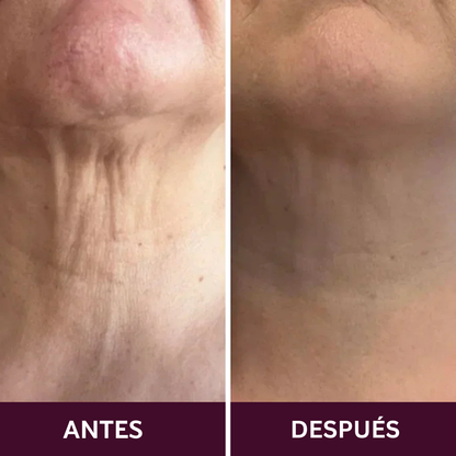 Crema Reafirmante para Cuello de Solvia