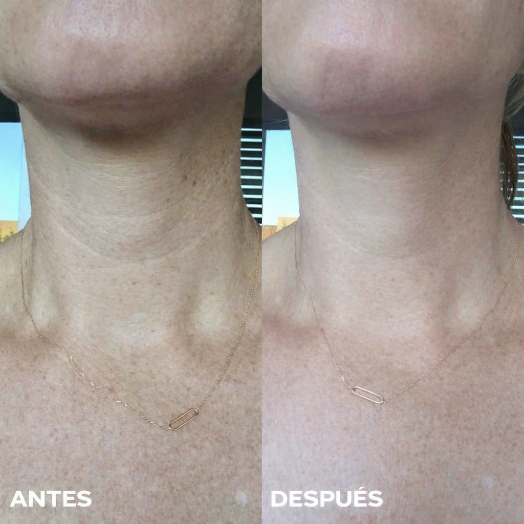 Mascarilla de Cuello Bio-Colágeno de Solvia