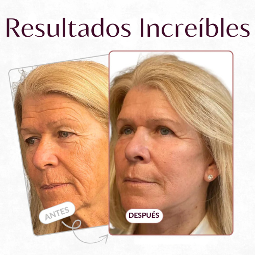 Bálsamo Anti-Arrugas Solvia