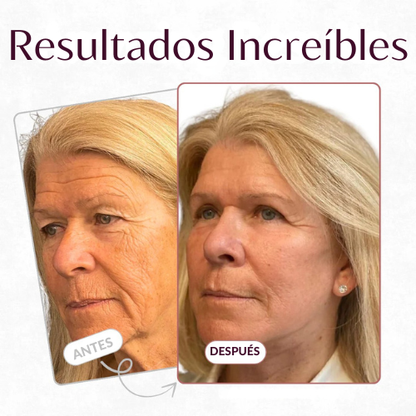 Bálsamo Anti-Arrugas Solvia